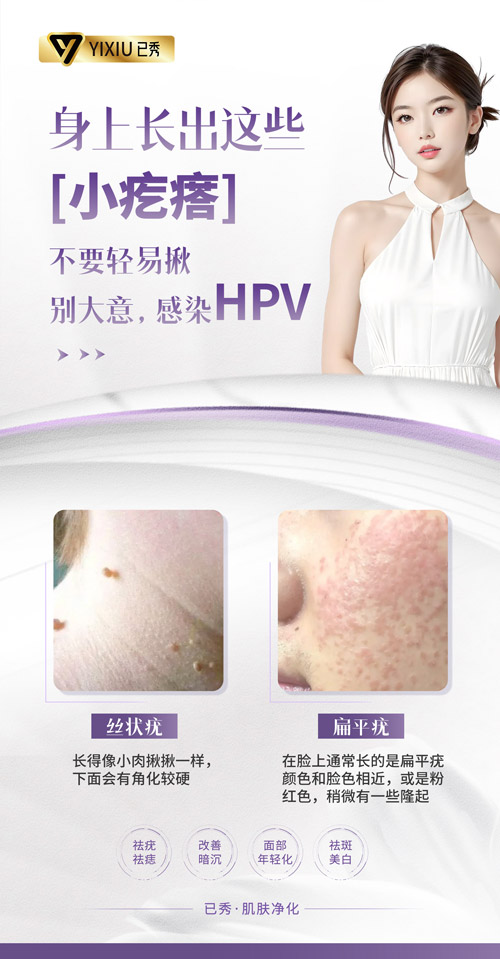 已秀纤体瘦身减肥合作连锁店